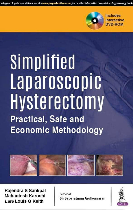 Simplified Laparoscopic Hysterectomy: Practical, Safe and Economic Methodology - Retail Maharaj