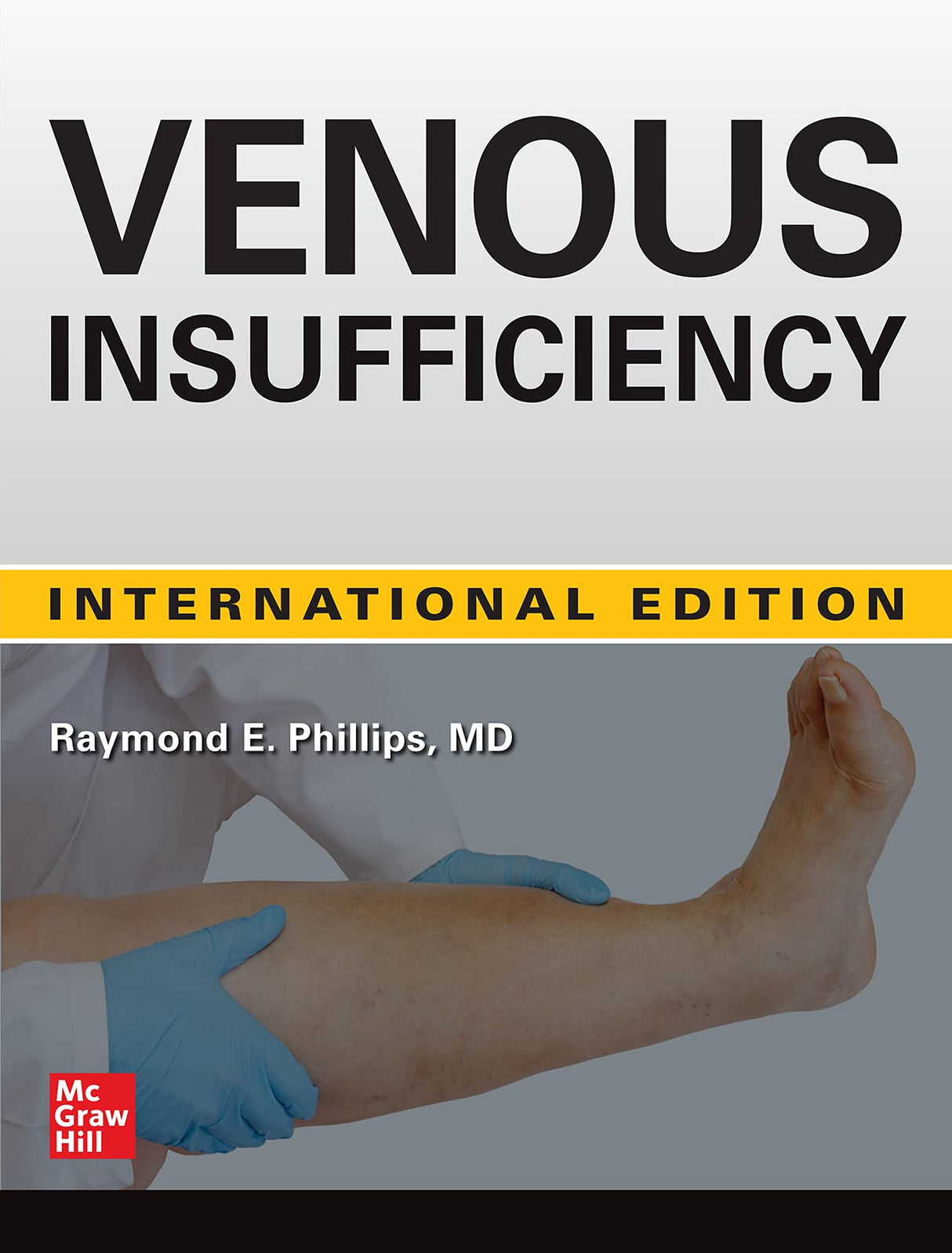 Venous Insufficiency - Retail Maharaj