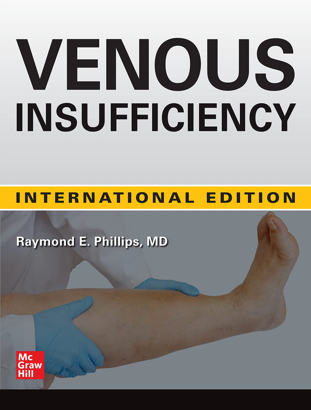 Venous Insufficiency - Retail Maharaj