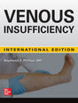 Venous Insufficiency - Retail Maharaj