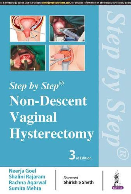 STEP BY STEP NON-DESCENT VAGINAL HYSTERECTOMY - Retail Maharaj