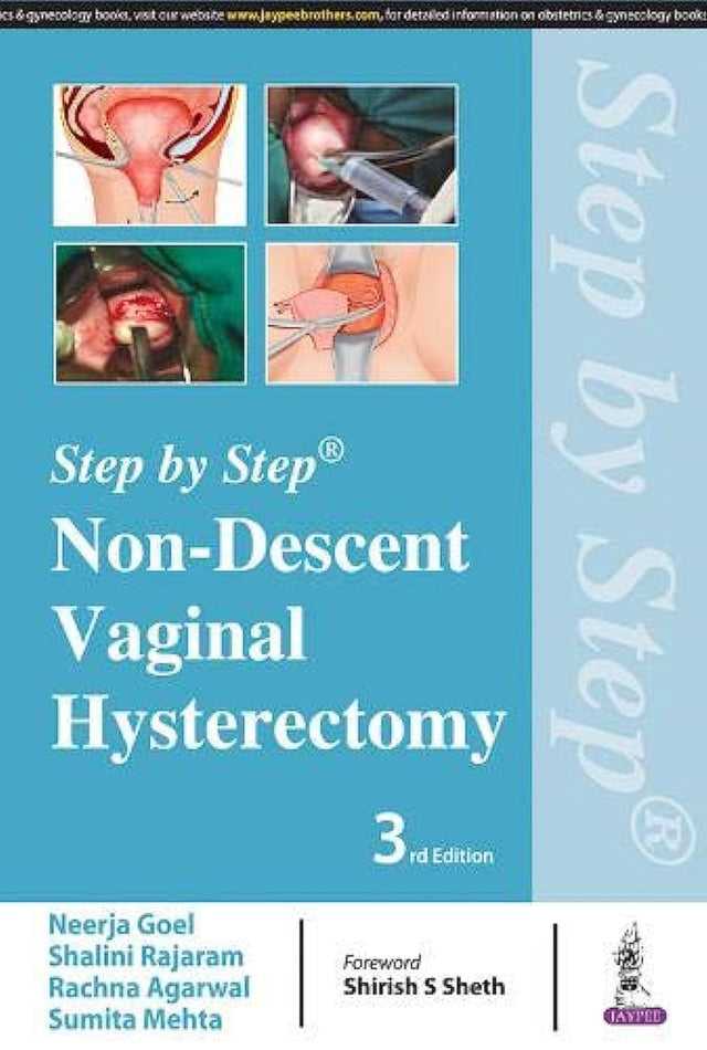 STEP BY STEP NON-DESCENT VAGINAL HYSTERECTOMY - Retail Maharaj