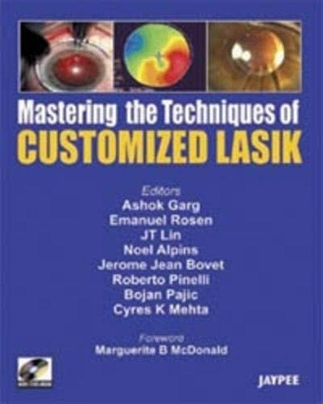 Mastering the Technique of Customized LASIK (with DVD-ROM) (POD) - Retail Maharaj