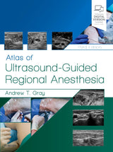 Atlas of Ultrasound-Guided Regional Anesthesia: Expert Consult -3E - Retail Maharaj