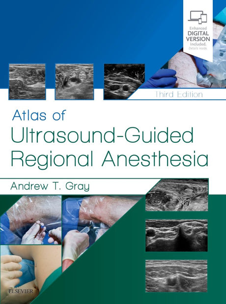Atlas of Ultrasound-Guided Regional Anesthesia: Expert Consult -3E - Retail Maharaj
