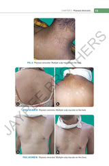 FUNGAL INFECTIONS WITH COLOR ALTAS - Retail Maharaj