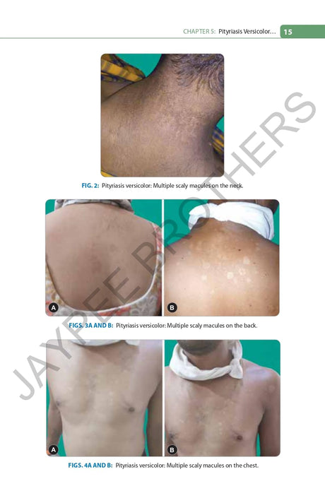 FUNGAL INFECTIONS WITH COLOR ALTAS - Retail Maharaj