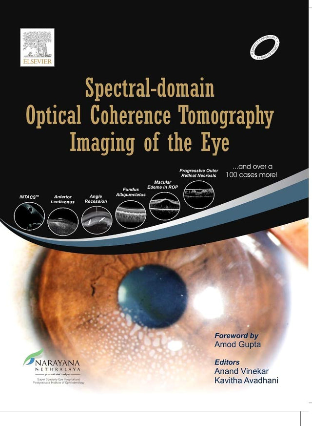 Spectral Domain Optical Coherence Tomography Imaging of the Eye, 1e - Retail Maharaj