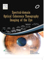 Spectral Domain Optical Coherence Tomography Imaging of the Eye, 1e - Retail Maharaj