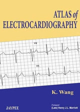 Atlas of Electrocardiography - Retail Maharaj