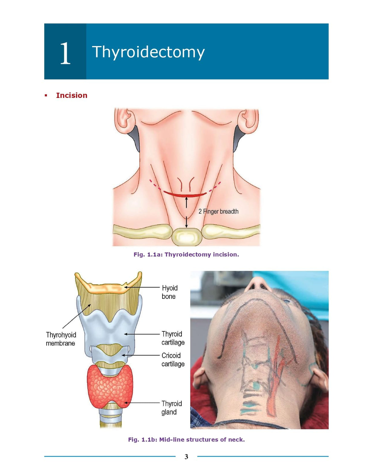 Essential Surgical Anatomy 1st/2026 - Retail Maharaj