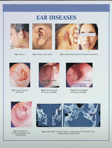 MANUAL OF ENT, HEAD & NECK SURGERY - Retail Maharaj