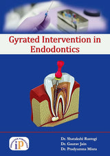 Gyrated Intervention in Endodontics - Retail Maharaj