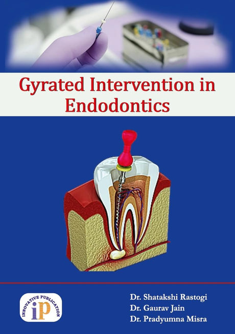 Gyrated Intervention in Endodontics - Retail Maharaj