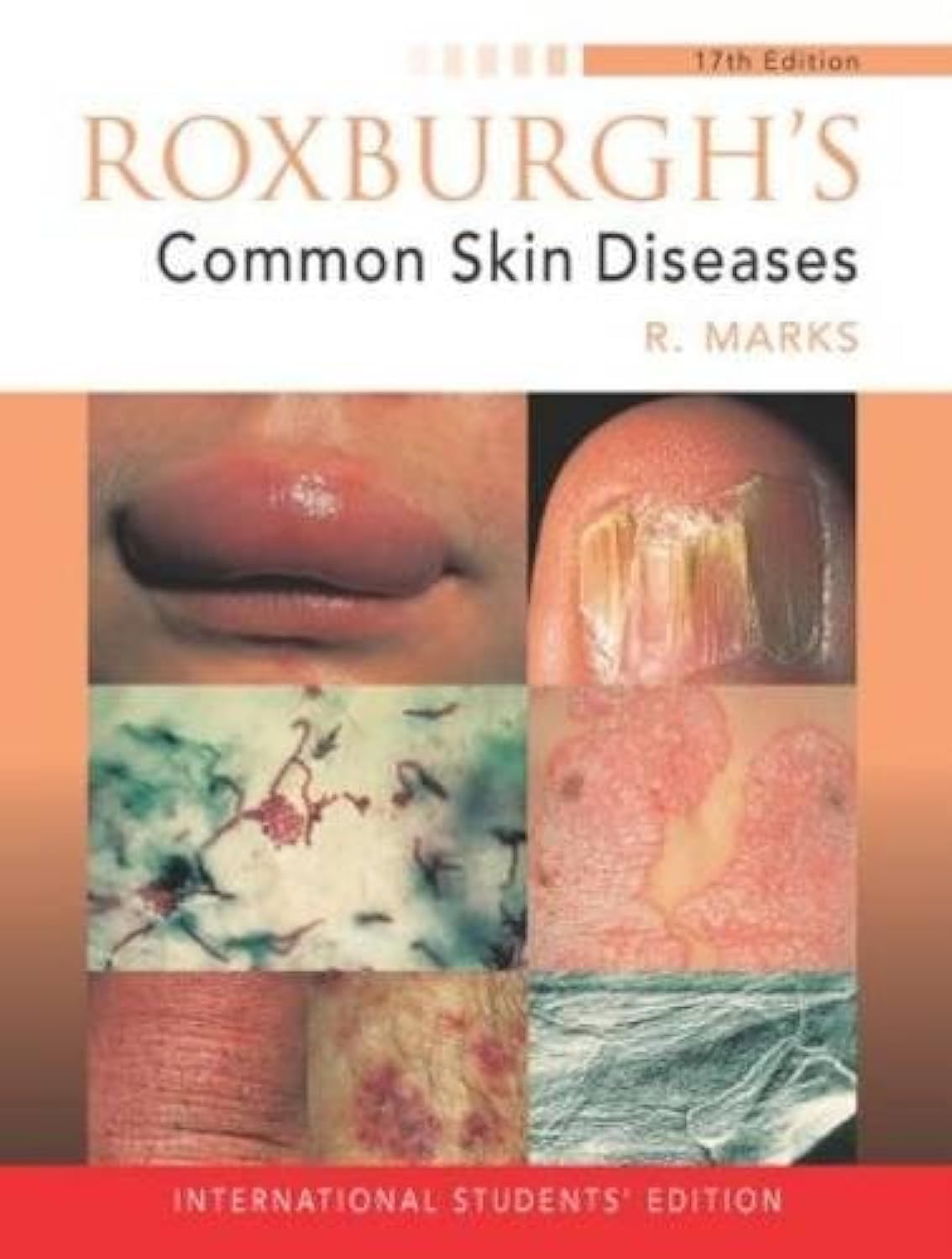 (EX)(OLD)ROXBURGH'S COMMON SKIN DISEASES - Retail Maharaj