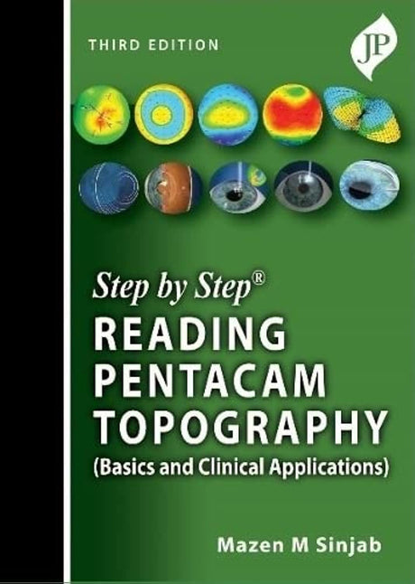 STEP BY STEP READING PENTACAM TOPOGRAPHY (BASICS AND CLINICAL APPLICATIONS) - Retail Maharaj