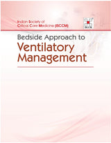 Bedside Approach to Ventilatory Management - Retail Maharaj