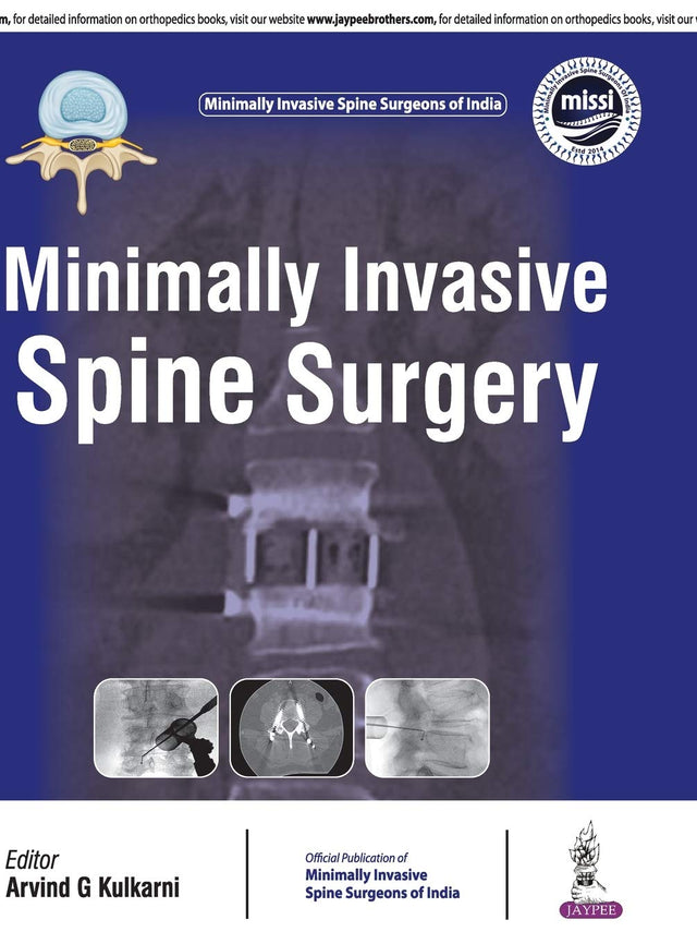 MINIMALLY INVASIVE SPINE SURGERY(OFFICIAL PUBLICATION OF MINIMALLY INVASIVE SPINE SURGEONS OF INDIA) - Retail Maharaj