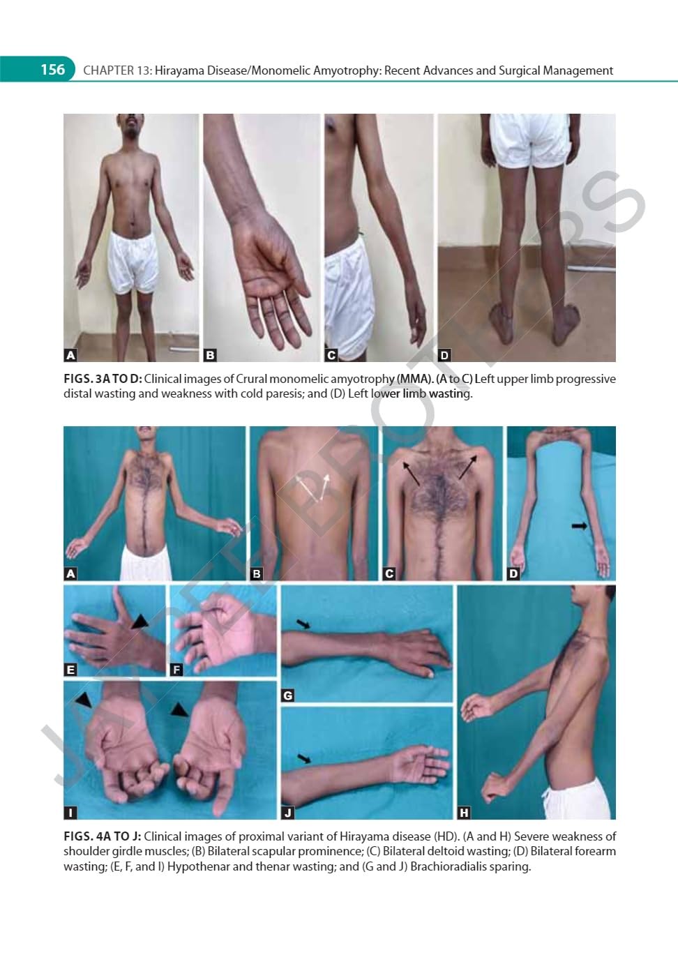 IAN ADVANCES IN NEUROMUSCULAR DISORDERS - Retail Maharaj