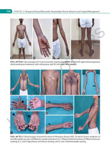 IAN ADVANCES IN NEUROMUSCULAR DISORDERS - Retail Maharaj