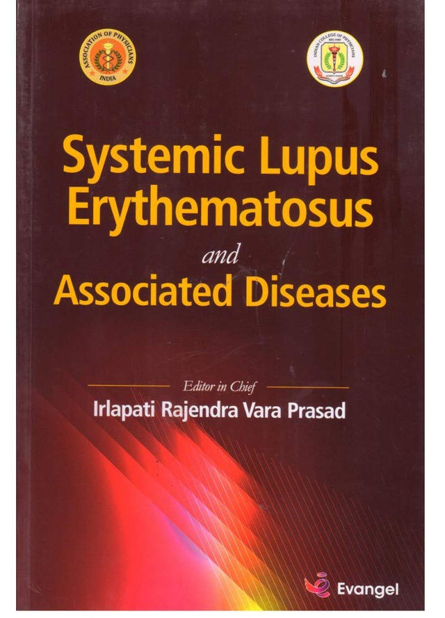 Systemic Lupus Erythematosus and Associated Disease - Retail Maharaj