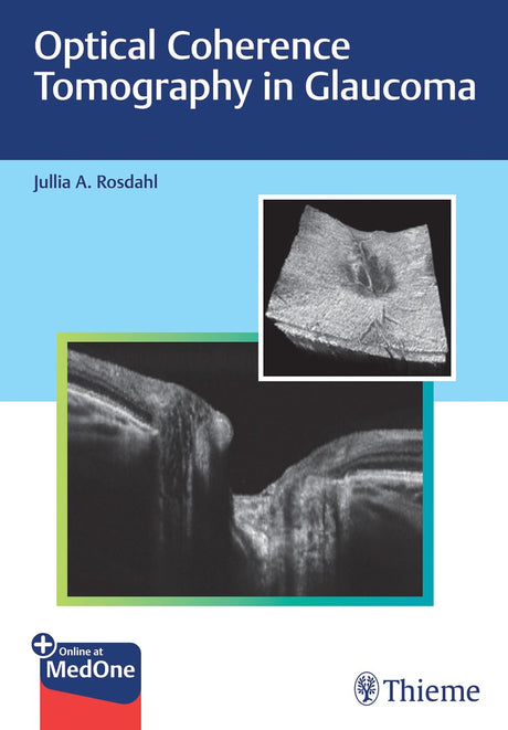 Optical Coherence Tomography in Glaucoma - Retail Maharaj