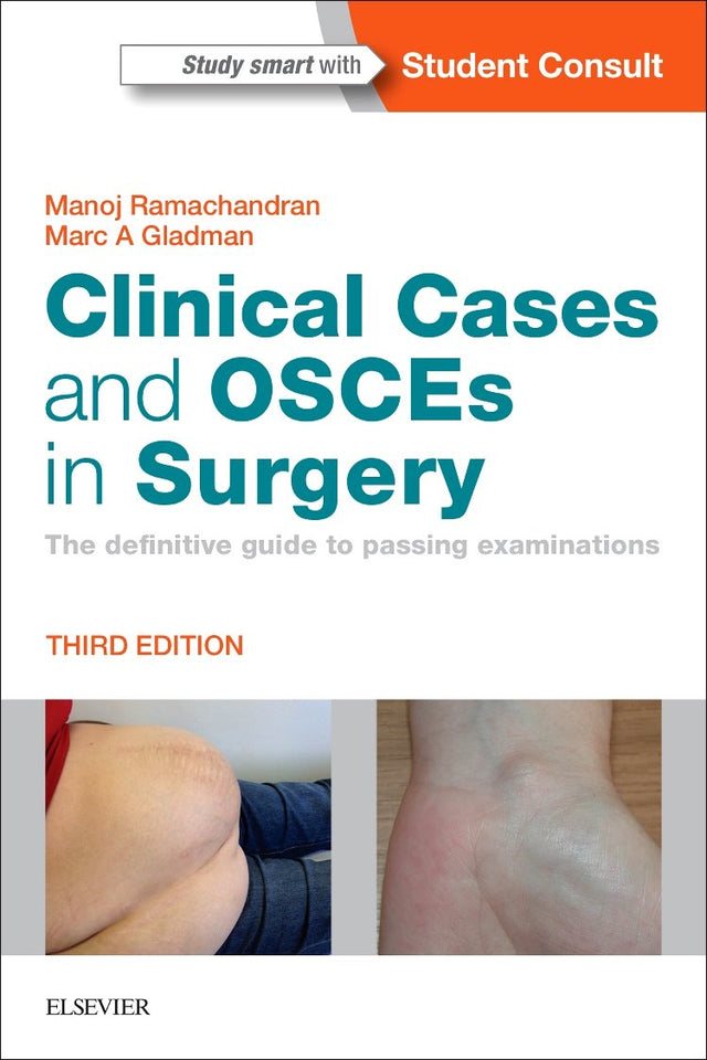 Clinical Cases and OSCEs in Surgery - Retail Maharaj