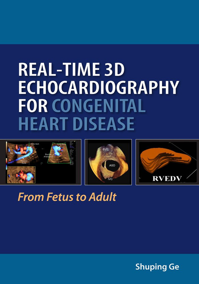 REAL-TIME 3D ECHOCARDIOGRAPHY FOR CONGENITAL HEART DISEASE - Retail Maharaj