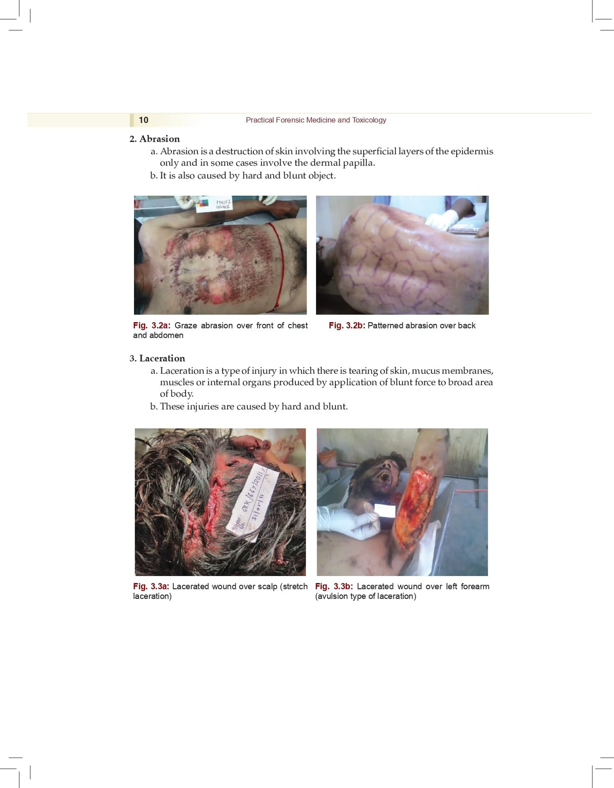 Practical Forensic Medicine and Toxicology, 2/e | As per the latest NMC Guidelines (PB 2026) - Retail Maharaj