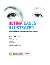 Retina Cases Illustrated - Retail Maharaj