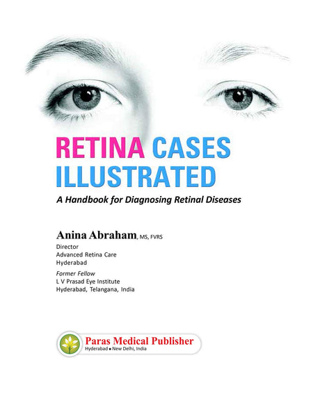 Retina Cases Illustrated - Retail Maharaj