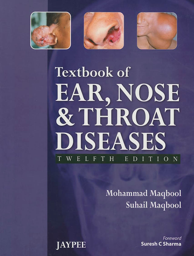 Textbook of Ear, Nose and Throat Diseases - Retail Maharaj