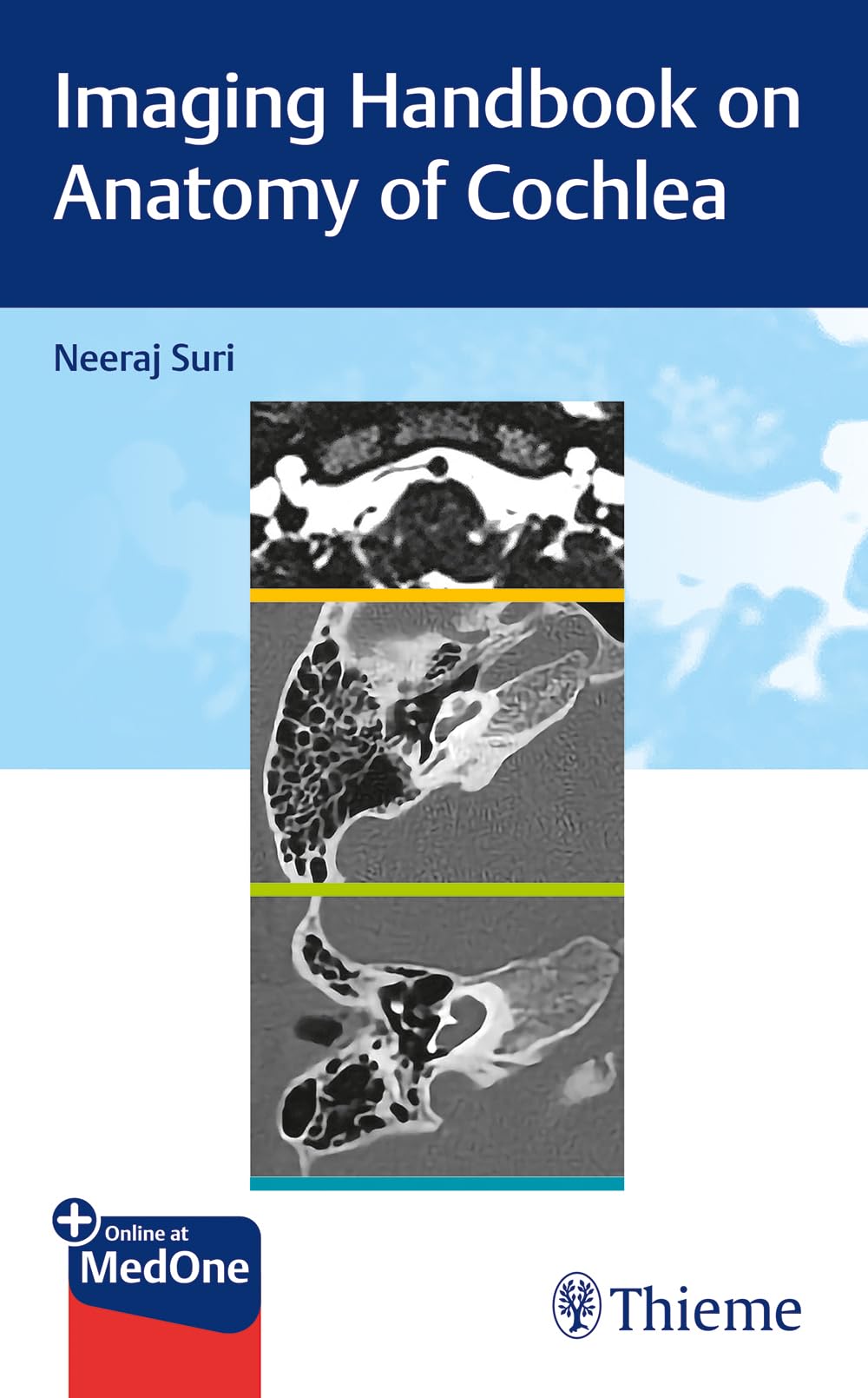 Imaging Handbook on Anatomy of Cochlea - Retail Maharaj