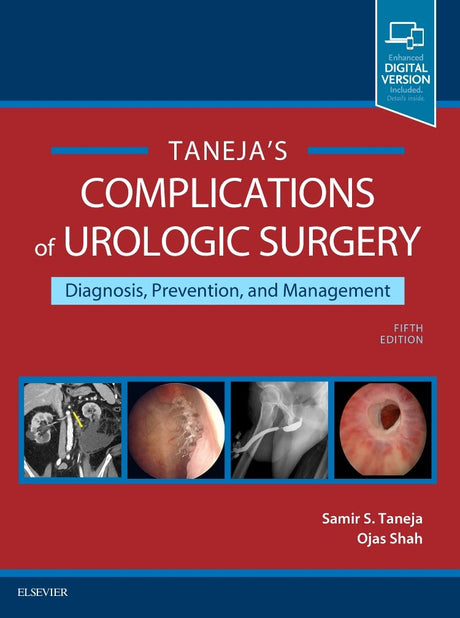 COMPLICATIONS OF UROLOGIC SURGERY, 5TH EDITION: Prevention and Management - Retail Maharaj