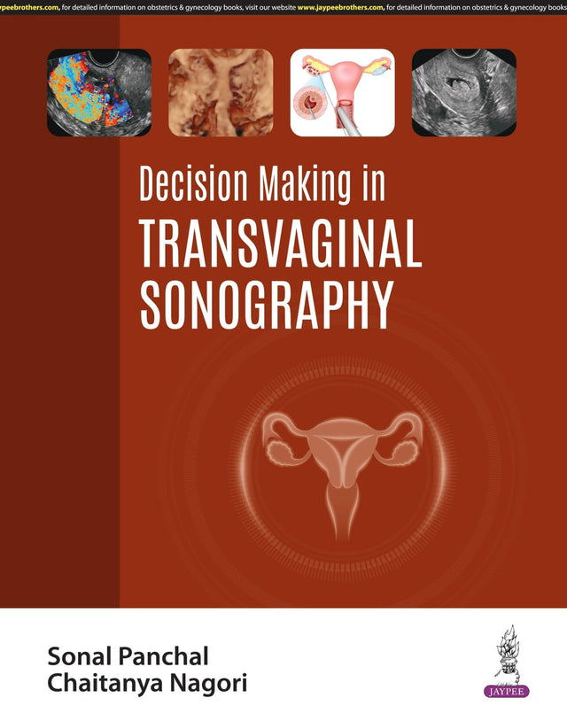 DECISION MAKING IN TRANSVAGINAL SONOGRAPHY - Retail Maharaj