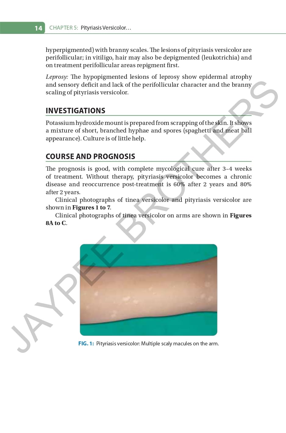 FUNGAL INFECTIONS WITH COLOR ALTAS - Retail Maharaj