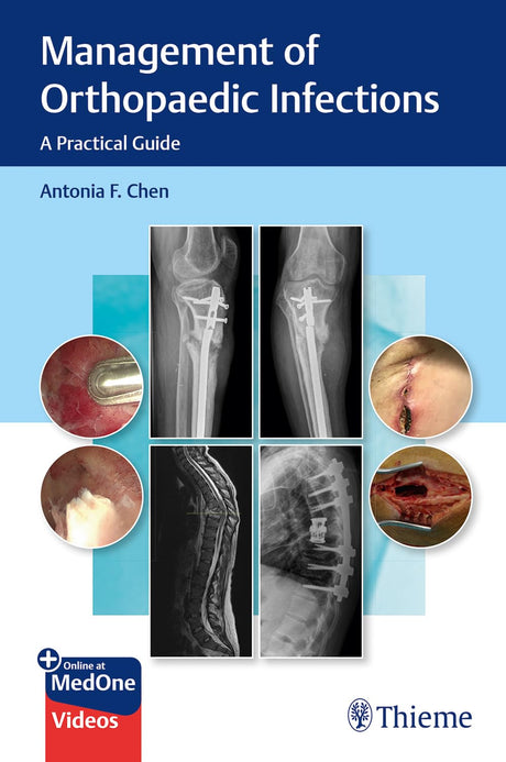Management of Orthopaedic Infections: A Practical Guide - Retail Maharaj