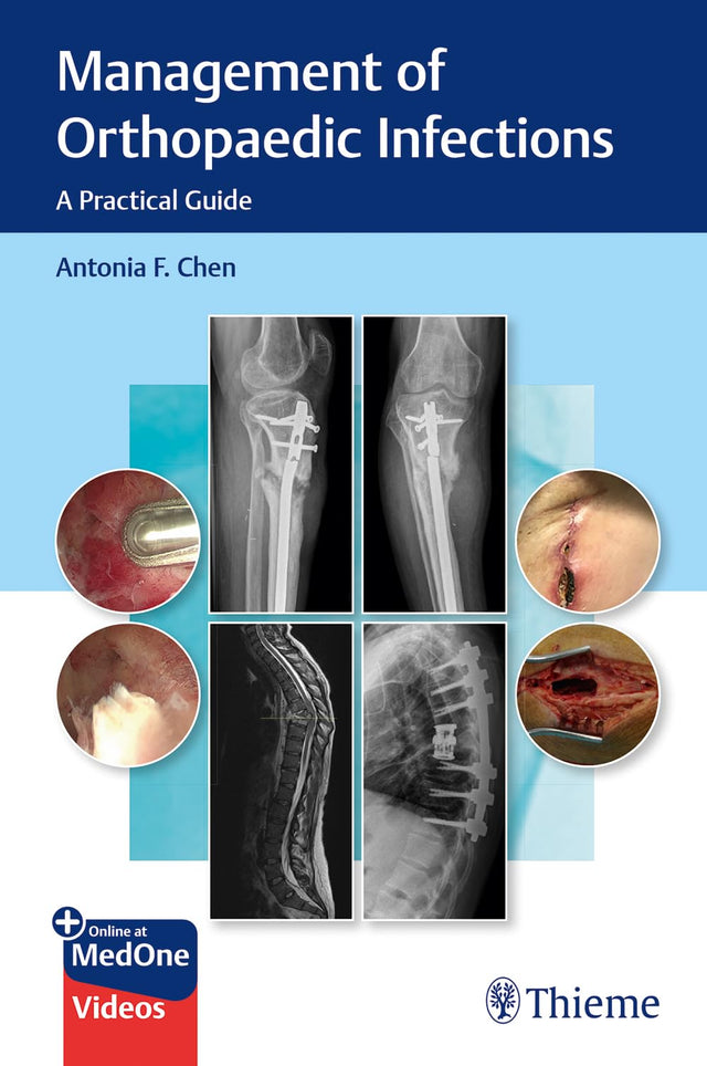 Management of Orthopaedic Infections: A Practical Guide - Retail Maharaj