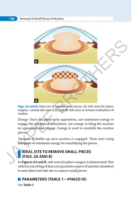 SIMPLIFIED PHACOEMULSIFICATION - Retail Maharaj