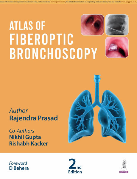 ATLAS OF FIBEROPTIC BRONCHOSCOPY - Retail Maharaj