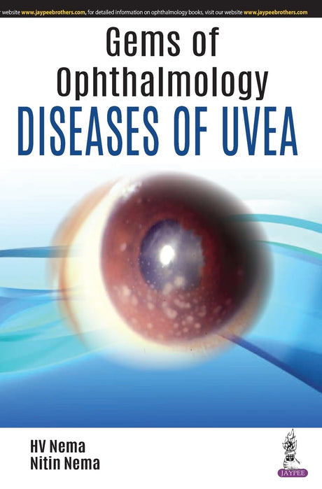 Gems in Ophthalmology—Diseases of Uvea - Retail Maharaj