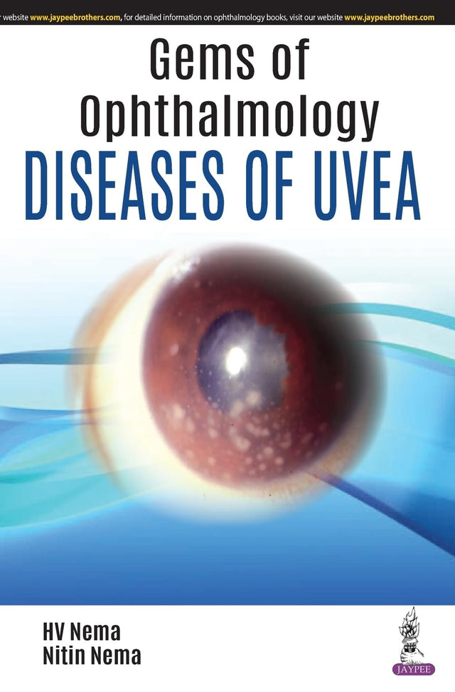 Gems in Ophthalmology—Diseases of Uvea - Retail Maharaj