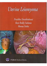 Uterine Leiomyoma 1st Ed. 2019 - Retail Maharaj