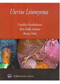 Uterine Leiomyoma 1st Ed. 2019 - Retail Maharaj