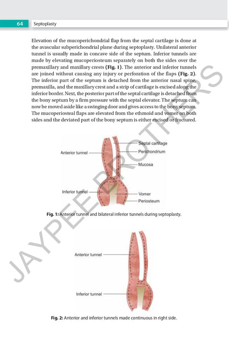 RHINOPLASTY AN EXPERT MANUAL - Retail Maharaj