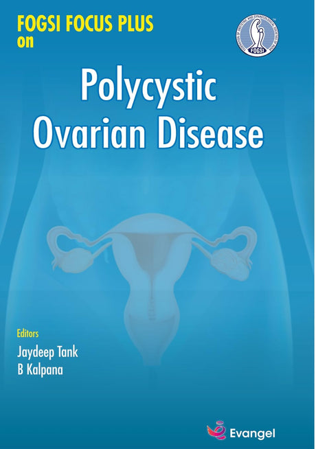 FOGSI FOCUS Plus on Polycystic Ovarian Disease - Retail Maharaj