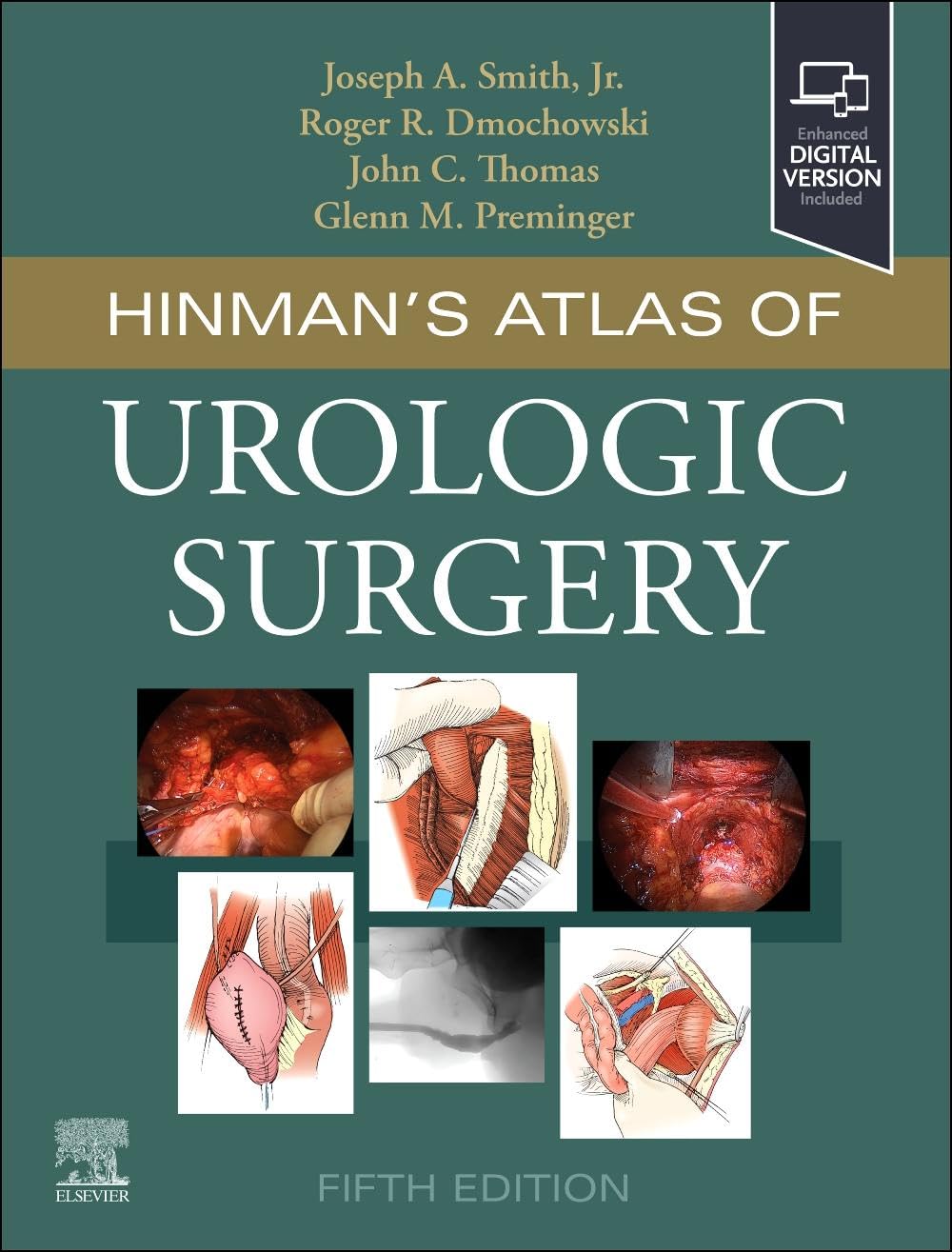 Hinman's Atlas of Urologic Surgery - Retail Maharaj