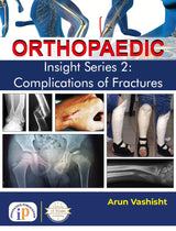 Orthopaedic Insight Series 2: Complications of Fractures - Retail Maharaj
