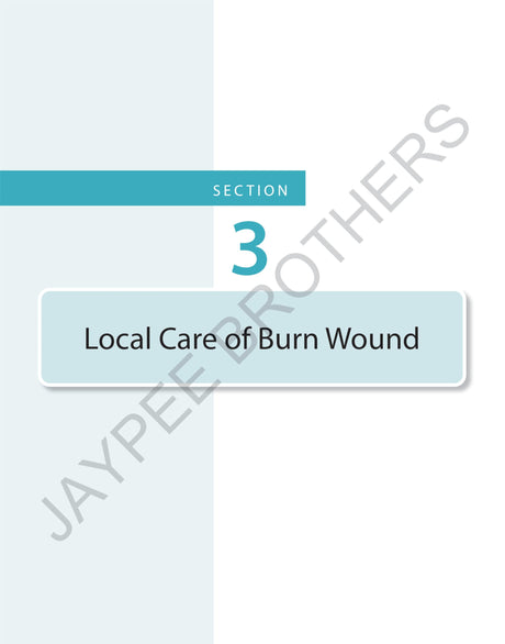 PRINCIPLES AND PRACTICE OF BURN CARE - Retail Maharaj
