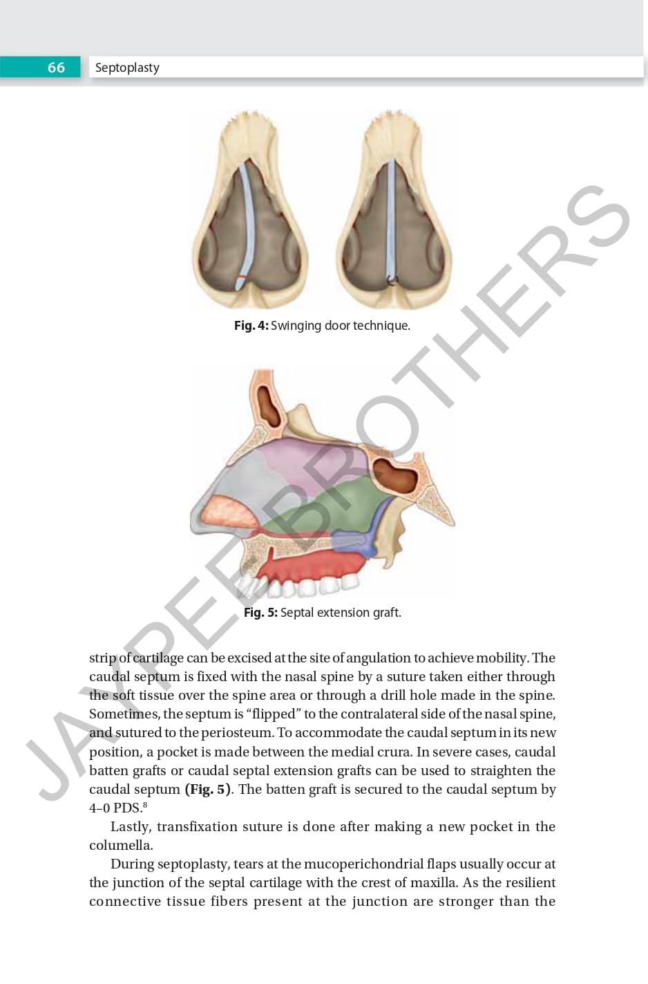 RHINOPLASTY AN EXPERT MANUAL - Retail Maharaj